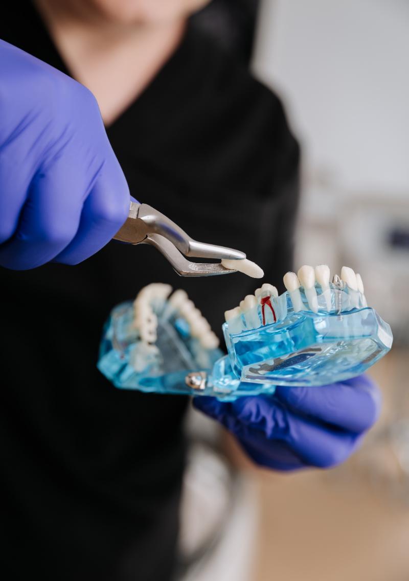 Ekstrakcija zuba - Dental Pollak